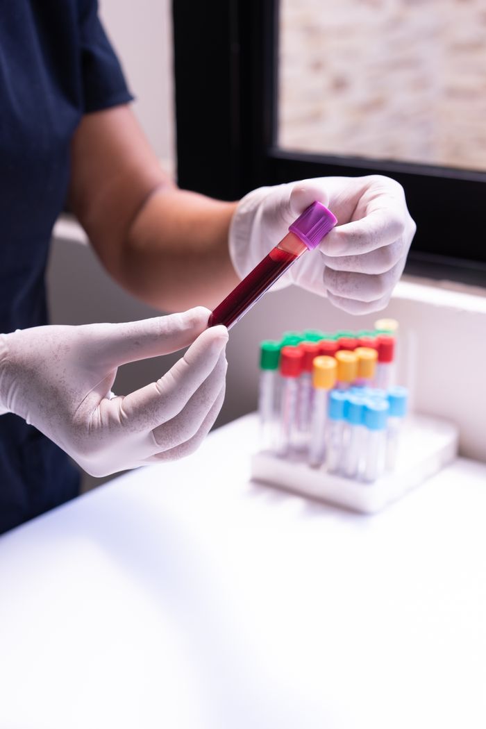 The Art of Drawing Readers In: Your attractive post title goes here A healthcare worker examines a blood sample in test tubes, emphasizing medical precision and care.